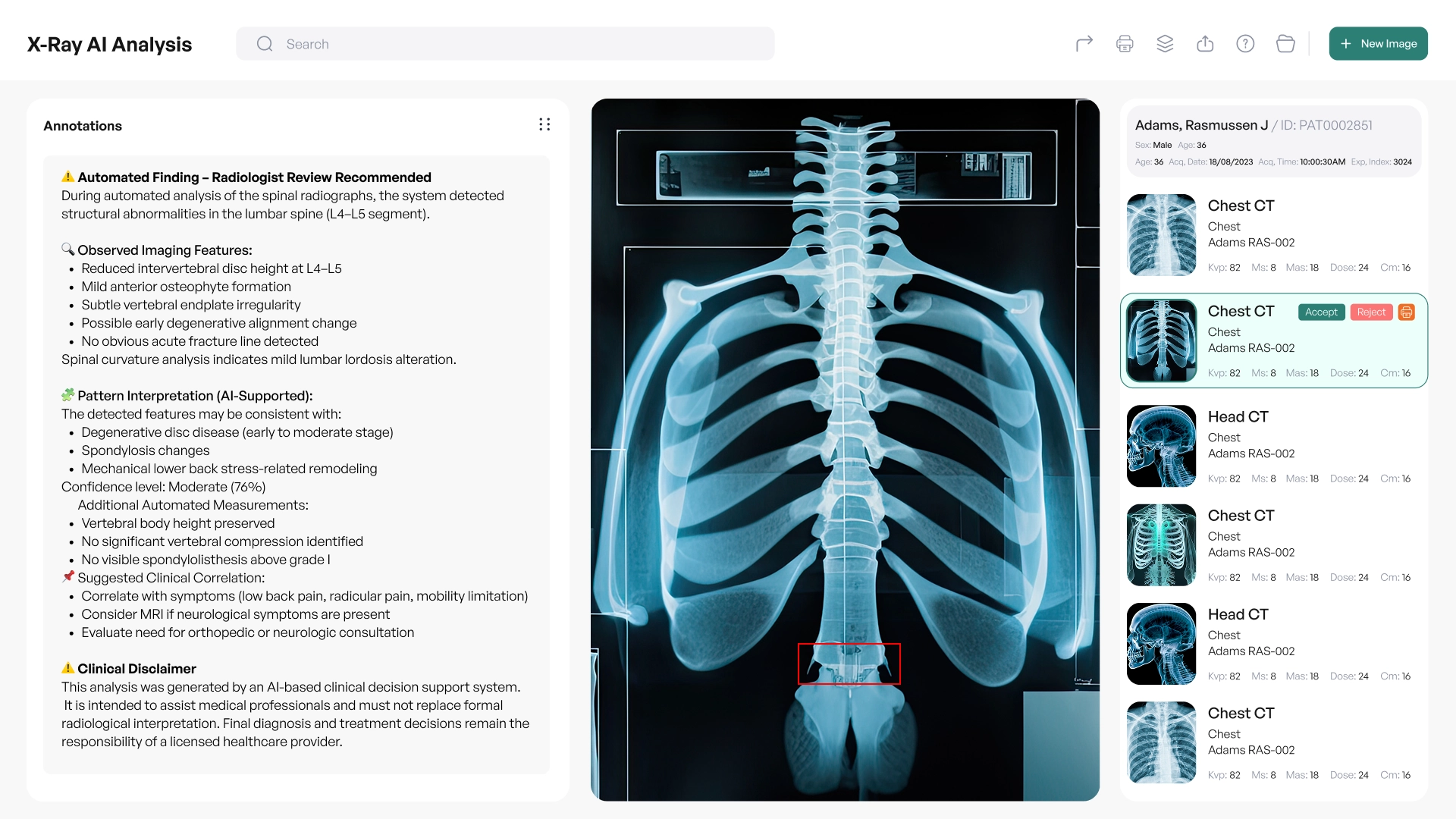 AI-інструмент для аналізу медичних зображень
